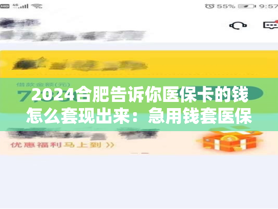 2024合肥告诉你医保卡的钱怎么套现出来:急用钱套医保卡怎么套出来 第1张 2024合肥告诉你医保卡的钱怎么套现出来:急用钱套医保卡怎么套出来 第1张