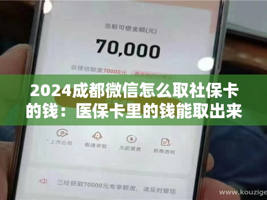 2024郑州急用钱套医保卡联系方式:(解答你的疑惑) 2024郑州急用钱套医保卡联系方式:(解答你的疑惑)